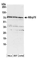 CCDC55 Antibody - Detection of human NSrp70 by western blot. Samples: Whole cell lysate (50 µg) from HeLa, HEK293T, and Jurkat cells prepared using NETN lysis buffer. Antibodies: Affinity purified rabbit anti-NSrp70 antibody used for WB at 0.1 µg/ml. Detection: Chemiluminescence with an exposure time of 3 minutes.