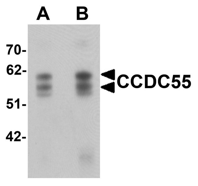 CCDC55 Antibody - Western blot analysis of CCDC55 in human brain tissue lysate with CCDC55 antibody at (A) 0.5 and (B) 1 ug/ml