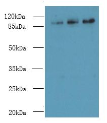CCDC57 Antibody - Western blot. All lanes: CCDC57 antibody at 1.2 ug/ml. Lane 1: U251 whole cell lysate. Lane 2: PC-3 whole cell lysate. Lane 3: HepG-2 whole cell lysate. Secondary Goat polyclonal to Rabbit IgG at 1:10000 dilution. Predicted band size: 103 kDa. Observed band size: 103 kDa.