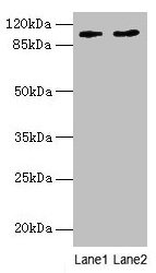 CCDC57 Antibody - Western blot All lanes: CCDC57 antibody at 1.2µg/ml Lane 1: U251 whole cell lysate Lane 2: PC-3 whole cell lysate Lane 3: HepG2 whole cell lysate Secondary Goat polyclonal to rabbit IgG at 1/10000 dilution Predicted band size: 104, 86 kDa Observed band size: 104 kDa