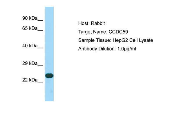 CCDC59 Antibody -  This image was taken for the unconjugated form of this product. Other forms have not been tested.