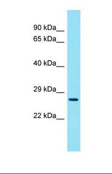 CCDC59 Antibody - Western blot of Mouse Thymus. Ccdc59 antibody dilution 1.0 ug/ml.  This image was taken for the unconjugated form of this product. Other forms have not been tested.