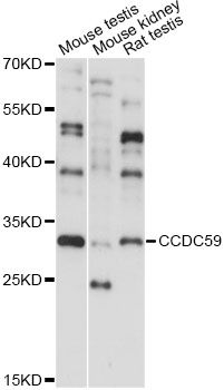 CCDC59 Antibody - Western blot analysis of extracts of various cell lines, using CCDC59 antibody at 1:1000 dilution. The secondary antibody used was an HRP Goat Anti-Rabbit IgG (H+L) at 1:10000 dilution. Lysates were loaded 25ug per lane and 3% nonfat dry milk in TBST was used for blocking. An ECL Kit was used for detection and the exposure time was 15s.