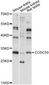 CCDC59 Antibody - Western blot analysis of extracts of various cell lines, using CCDC59 antibody at 1:1000 dilution. The secondary antibody used was an HRP Goat Anti-Rabbit IgG (H+L) at 1:10000 dilution. Lysates were loaded 25ug per lane and 3% nonfat dry milk in TBST was used for blocking. An ECL Kit was used for detection and the exposure time was 15s.