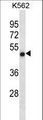 CCDC6 Antibody - CCDC6 Antibody western blot of K562 cell line lysates (35 ug/lane). The CCDC6 antibody detected the CCDC6 protein (arrow).