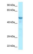 CCDC6 Antibody - CCDC6 antibody Western Blot of Mouse Liver.  This image was taken for the unconjugated form of this product. Other forms have not been tested.
