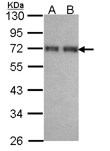 CCDC6 Antibody - Sample (30 ug of whole cell lysate). A: H1299. B: Hela. 10% SDS PAGE. CCDC6 antibody diluted at 1:1000. 