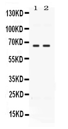 CCDC6 Antibody - Western blot - Anti-CCDC6 Picoband Antibody