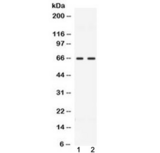 CCDC6 Antibody - Western blot testing of 1) rat testis and 2) human MCF7 lysate with CCDC6 antibody at 0.5ug/ml. Predicted molecular weight ~53 kDa, routinely observed at ~65 kDa.