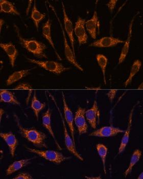 CCDC6 Antibody - Immunofluorescence analysis of L929 cells using CCDC6 Polyclonal Antibody at dilution of 1:100.Blue: DAPI for nuclear staining.