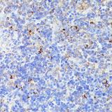 CCDC6 Antibody - Immunohistochemistry of paraffin-embedded Rat lymph node using CCDC6 Polyclonal Antibody at dilution of 1:100 (40x lens).