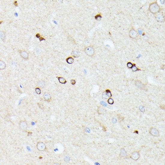CCDC6 Antibody - Immunohistochemistry of paraffin-embedded Rat brain using CCDC6 Polyclonal Antibody at dilution of 1:100 (40x lens).