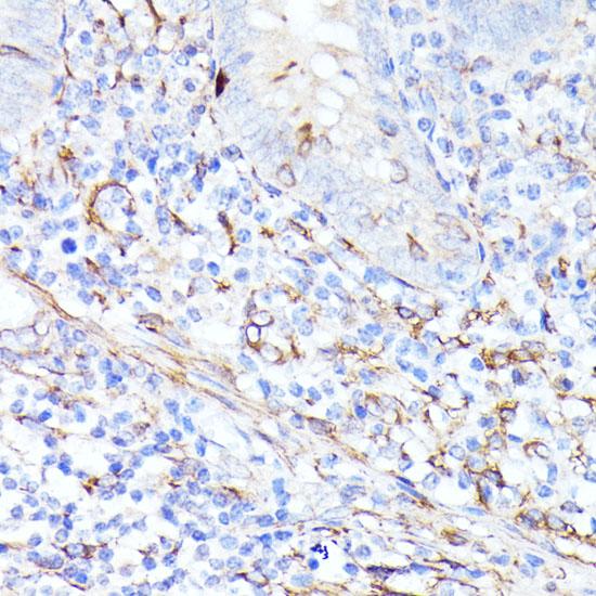 CCDC6 Antibody - Immunohistochemistry of paraffin-embedded Human appendix using CCDC6 Polyclonal Antibody at dilution of 1:100 (40x lens).