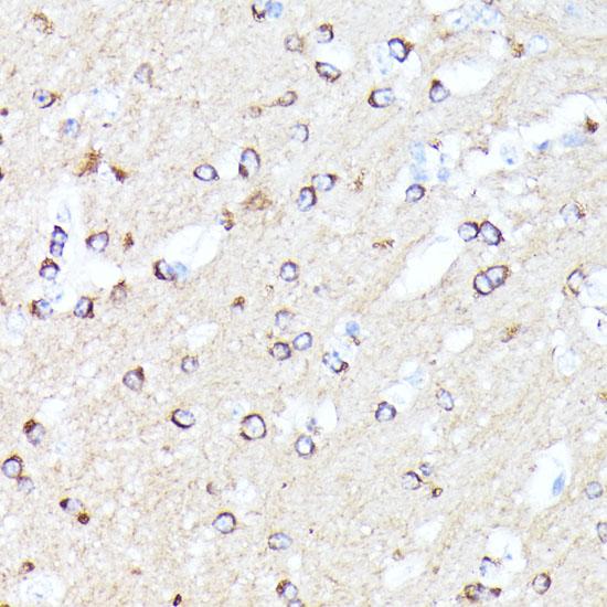 CCDC6 Antibody - Immunohistochemistry of paraffin-embedded Mouse brain using CCDC6 Polyclonal Antibody at dilution of 1:100 (40x lens).