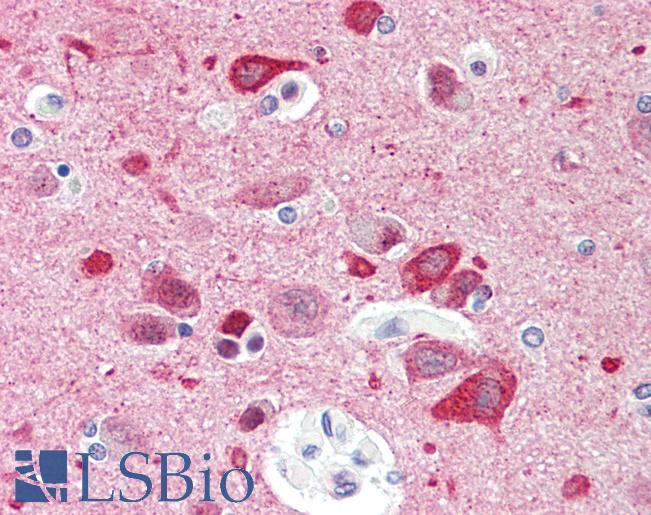 CCDC60 Antibody - Anti-CCDC60 antibody IHC staining of human brain, cortex. Immunohistochemistry of formalin-fixed, paraffin-embedded tissue after heat-induced antigen retrieval. Antibody concentration 10 ug/ml.  This image was taken for the unconjugated form of this product. Other forms have not been tested.