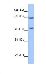 CCDC60 Antibody - MCF7 cell lysate. Antibody concentration: 1.0 ug/ml. Gel concentration: 12%.  This image was taken for the unconjugated form of this product. Other forms have not been tested.
