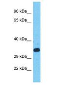 CCDC61 Antibody - CCDC61 antibody Western Blot of HepG2. Antibody dilution: 1 ug/ml.  This image was taken for the unconjugated form of this product. Other forms have not been tested.