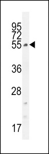 CCDC61 Antibody - CCDC61 Antibody western blot of K562 cell line lysates (35 ug/lane). The CCDC61 antibody detected the CCDC61 protein (arrow).