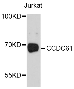 CCDC61 Antibody - Western blot analysis of extracts of Jurkat cells, using CCDC61 antibody at 1:1000 dilution. The secondary antibody used was an HRP Goat Anti-Rabbit IgG (H+L) at 1:10000 dilution. Lysates were loaded 25ug per lane and 3% nonfat dry milk in TBST was used for blocking. An ECL Kit was used for detection and the exposure time was 90s.
