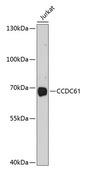 CCDC61 Antibody - Western blot analysis of extracts of Jurkat cells using CCDC61 Polyclonal Antibody at dilution of 1:1000.