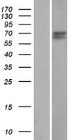 CCDC61 Protein - Western validation with an anti-DDK antibody * L: Control HEK293 lysate R: Over-expression lysate