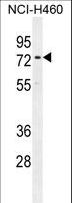 CCDC63 Antibody - CCDC63 Antibody western blot of NCI-H460 cell line lysates (35 ug/lane). The CCDC63 antibody detected the CCDC63 protein (arrow).