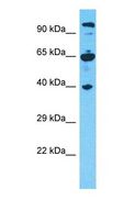 CCDC64 Antibody - Western blot of CCDC64 Antibody with human 293T Whole Cell lysate.  This image was taken for the unconjugated form of this product. Other forms have not been tested.