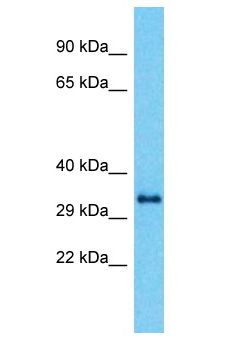 CCDC64B Antibody - CCDC64B antibody Western Blot of ACHN. Antibody dilution: 1 ug/ml.  This image was taken for the unconjugated form of this product. Other forms have not been tested.