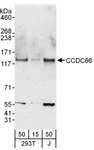 CCDC66 Antibody - Detection of Human CCDC66 by Western Blot. Samples: Whole cell lysate from 293T (15 and 50 ug) and Jurkat (J; 50 ug) cells. Antibodies: Affinity purified rabbit anti-CCDC66 antibody used for WB at 0.1 ug/ml. Detection: Chemiluminescence with an exposure time of 3 minutes.