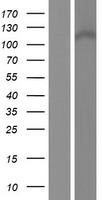 CCDC66 Protein - Western validation with an anti-DDK antibody * L: Control HEK293 lysate R: Over-expression lysate