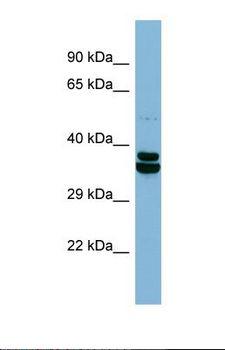 CCDC67 Antibody - Western blot of Human ACHN. CCDC67 antibody dilution 1.0 ug/ml.  This image was taken for the unconjugated form of this product. Other forms have not been tested.