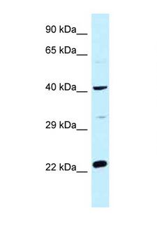 CCDC68 Antibody - CCDC68 antibody Western blot of Fetal Heart lysate. Antibody concentration 1 ug/ml.  This image was taken for the unconjugated form of this product. Other forms have not been tested.