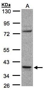 CCDC68 Antibody - Sample (30 ug whole cell lysate). A: Raji . 10% SDS PAGE. CCDC68 / SE57-1 antibody diluted at 1:1000