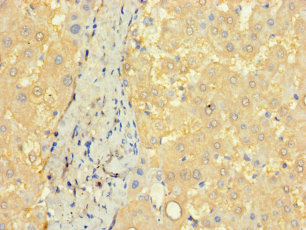 CCDC68 Antibody - Immunohistochemistry of paraffin-embedded human liver tissue using CCDC68 Antibody at dilution of 1:100