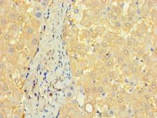 CCDC68 Antibody - Immunohistochemistry of paraffin-embedded human liver tissue using CCDC68 Antibody at dilution of 1:100