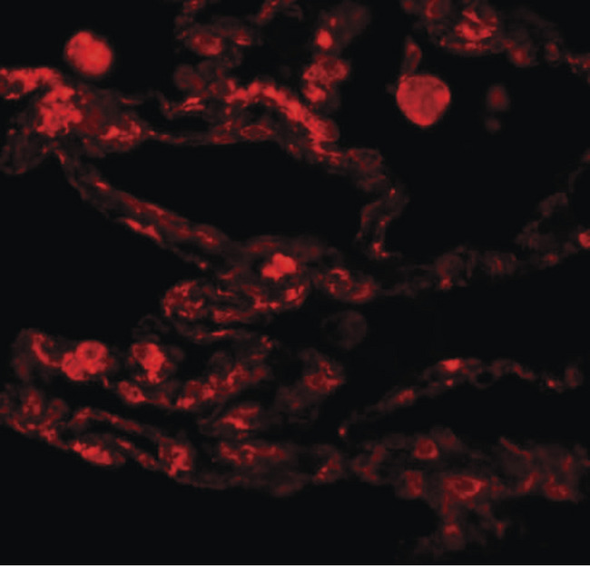 CCDC69 Antibody - Immunofluorescence of CCDC69 in human lung tissue with CCDC69 antibody at 20 ug/ml.