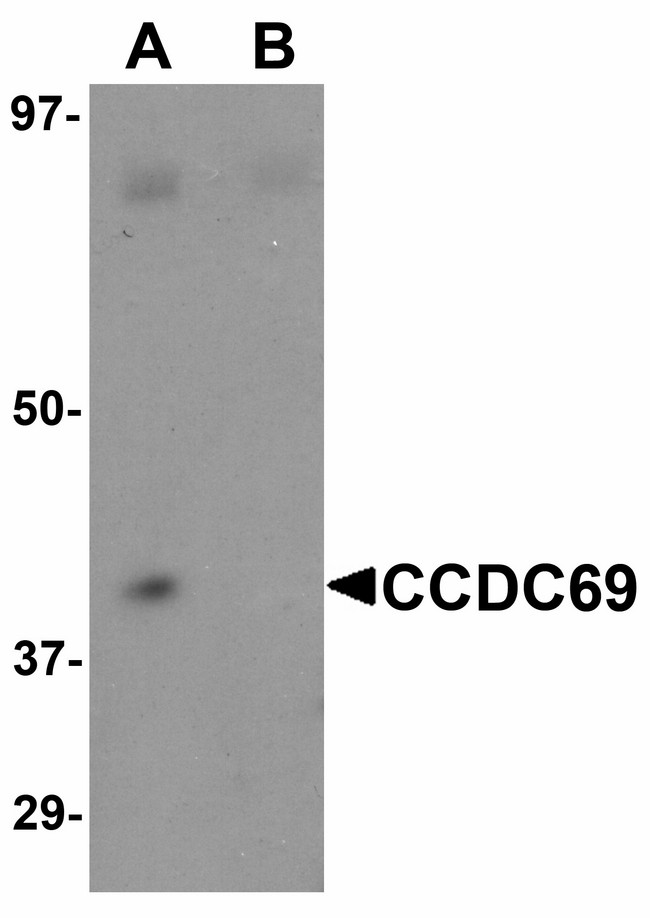 CCDC69 Antibody - Western blot of CCDC69 in mouse lung tissue lysate with CCDC69 antibody at 1 ug/ml in (A) the absence and (B) the presence of blocking peptide.