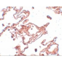 CCDC69 Antibody - Immunohistochemistry of CCDC69 in human lung tissue with CCDC69 antibody at 5 µg/mL.