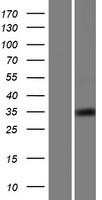 CCDC69 Protein - Western validation with an anti-DDK antibody * L: Control HEK293 lysate R: Over-expression lysate