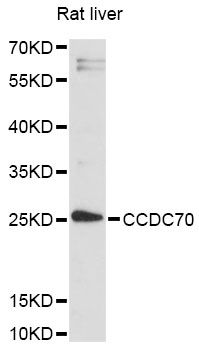 CCDC70 Antibody - Western blot analysis of extracts of rat liver, using CCDC70 antibody at 1:3000 dilution. The secondary antibody used was an HRP Goat Anti-Rabbit IgG (H+L) at 1:10000 dilution. Lysates were loaded 25ug per lane and 3% nonfat dry milk in TBST was used for blocking. An ECL Kit was used for detection and the exposure time was 90s.