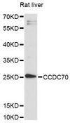CCDC70 Antibody - Western blot analysis of extracts of rat liver, using CCDC70 antibody at 1:3000 dilution. The secondary antibody used was an HRP Goat Anti-Rabbit IgG (H+L) at 1:10000 dilution. Lysates were loaded 25ug per lane and 3% nonfat dry milk in TBST was used for blocking. An ECL Kit was used for detection and the exposure time was 90s.