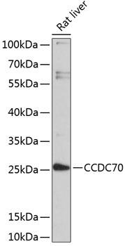 CCDC70 Antibody - Western blot analysis of extracts of rat liver using CCDC70 Polyclonal Antibody at dilution of 1:3000.