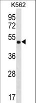 CCDC71 Antibody - CCDC71 Antibody western blot of K562 cell line lysates (35 ug/lane). The CCDC71 antibody detected the CCDC71 protein (arrow).