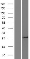 CCDC71L Protein - Western validation with an anti-DDK antibody * L: Control HEK293 lysate R: Over-expression lysate