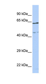 CCDC74A Antibody - CCDC74A antibody Western blot of MCF7 cell lysate. This image was taken for the unconjugated form of this product. Other forms have not been tested.