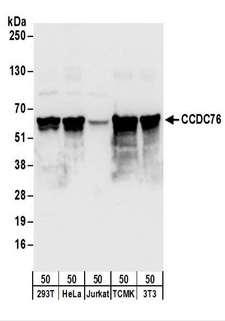 CCDC76 Antibody - Detection of Human and Mouse CCDC76 by Western Blot. Samples: Whole cell lysate (50 ug) from 293T, HeLa, Jurkat, mouse TCMK-1, and mouse NIH3T3 cells. Antibodies: Affinity purified rabbit anti-CCDC76 antibody used for WB at 0.1 ug/ml. Detection: Chemiluminescence with an exposure time of 3 seconds.
