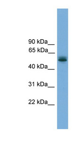 CCDC76 Antibody - CCDC76 antibody Western blot of Fetal Lung lysate. This image was taken for the unconjugated form of this product. Other forms have not been tested.