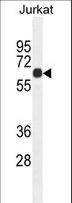 CCDC8 Antibody - CCDC8 Antibody western blot of Jurkat cell line lysates (35 ug/lane). The CCDC8 antibody detected the CCDC8 protein (arrow).