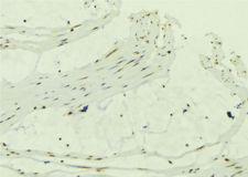 CCDC8 Antibody - 1:100 staining mouse muscle tissue by IHC-P. The sample was formaldehyde fixed and a heat mediated antigen retrieval step in citrate buffer was performed. The sample was then blocked and incubated with the antibody for 1.5 hours at 22°C. An HRP conjugated goat anti-rabbit antibody was used as the secondary.
