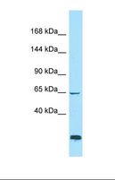 CCDC80 Antibody - Western blot of RPMI-8226. ADAMTSL1 antibody dilution 1.0 ug/ml.  This image was taken for the unconjugated form of this product. Other forms have not been tested.